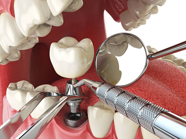 Best Broken or Cracked Tooth Emergency Dentist in Lightstreet, PA